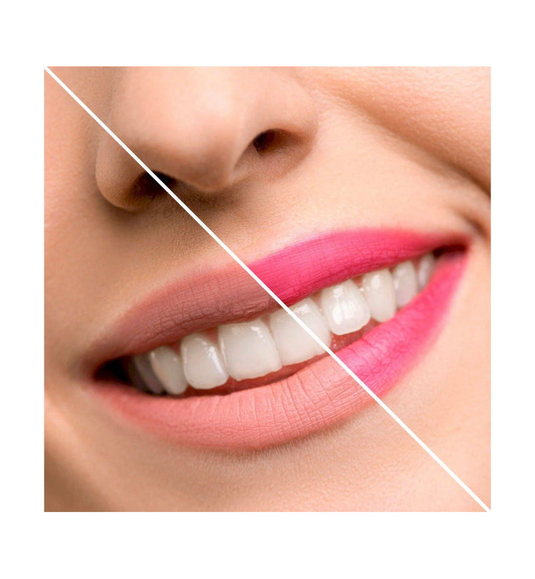 Bálsamo Labial Flor Fresa Vegano
Inuwet